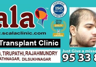 Scala Skin and Hair Transplant