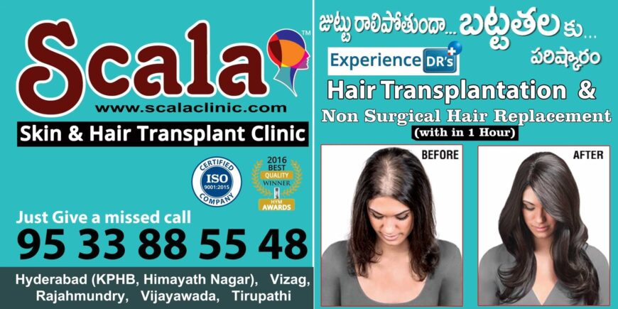 Scala Skin and Hair Transplant